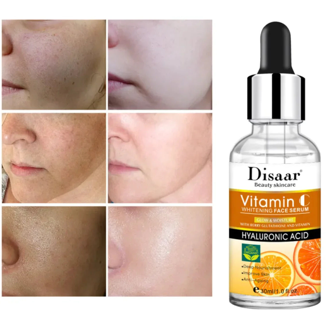 Hyaluronic Acid Serum: Unlock Radiant, Youthful Skin