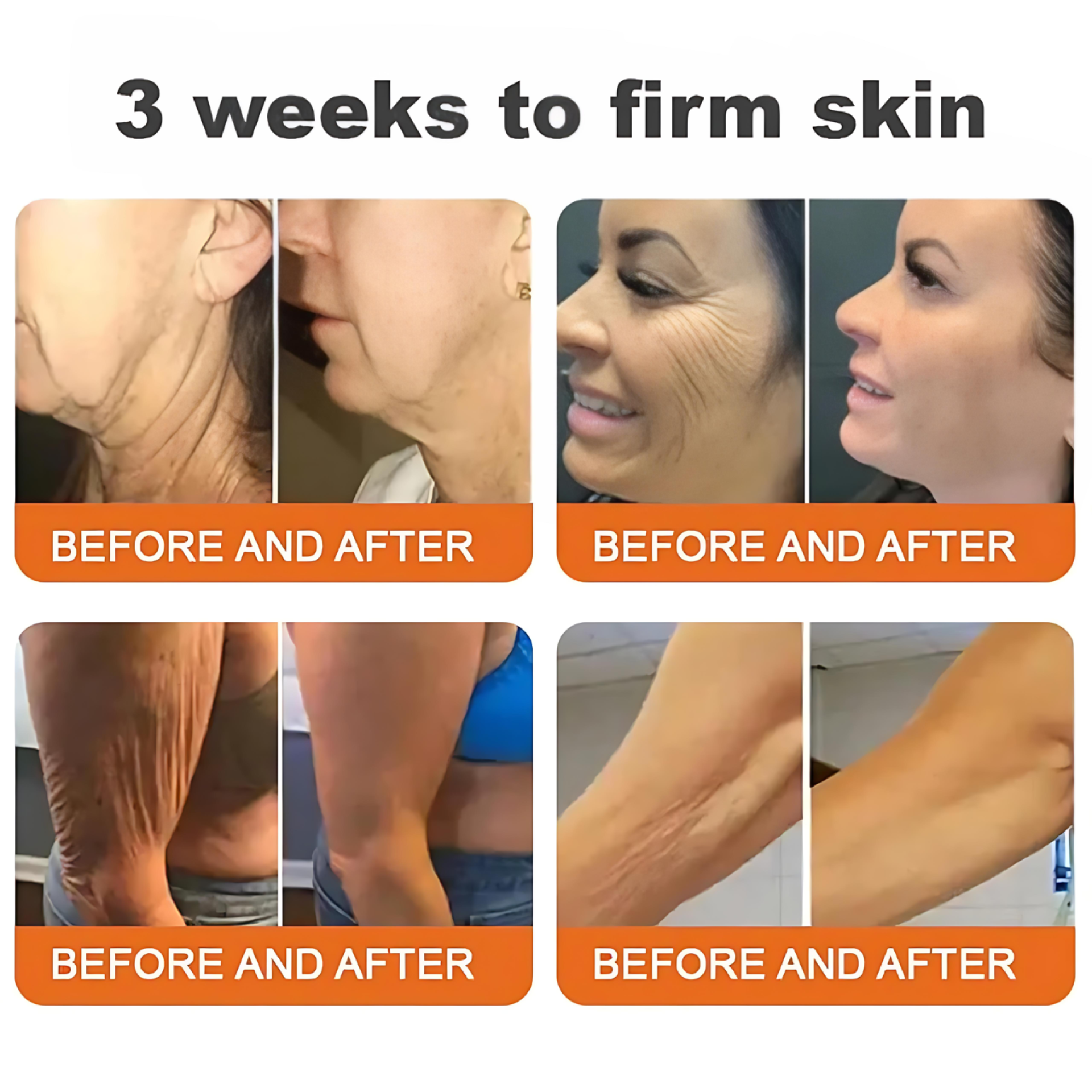 "Bee Venom Anti-Aging Facial Cream – Hydrates, Firms & Brightens"