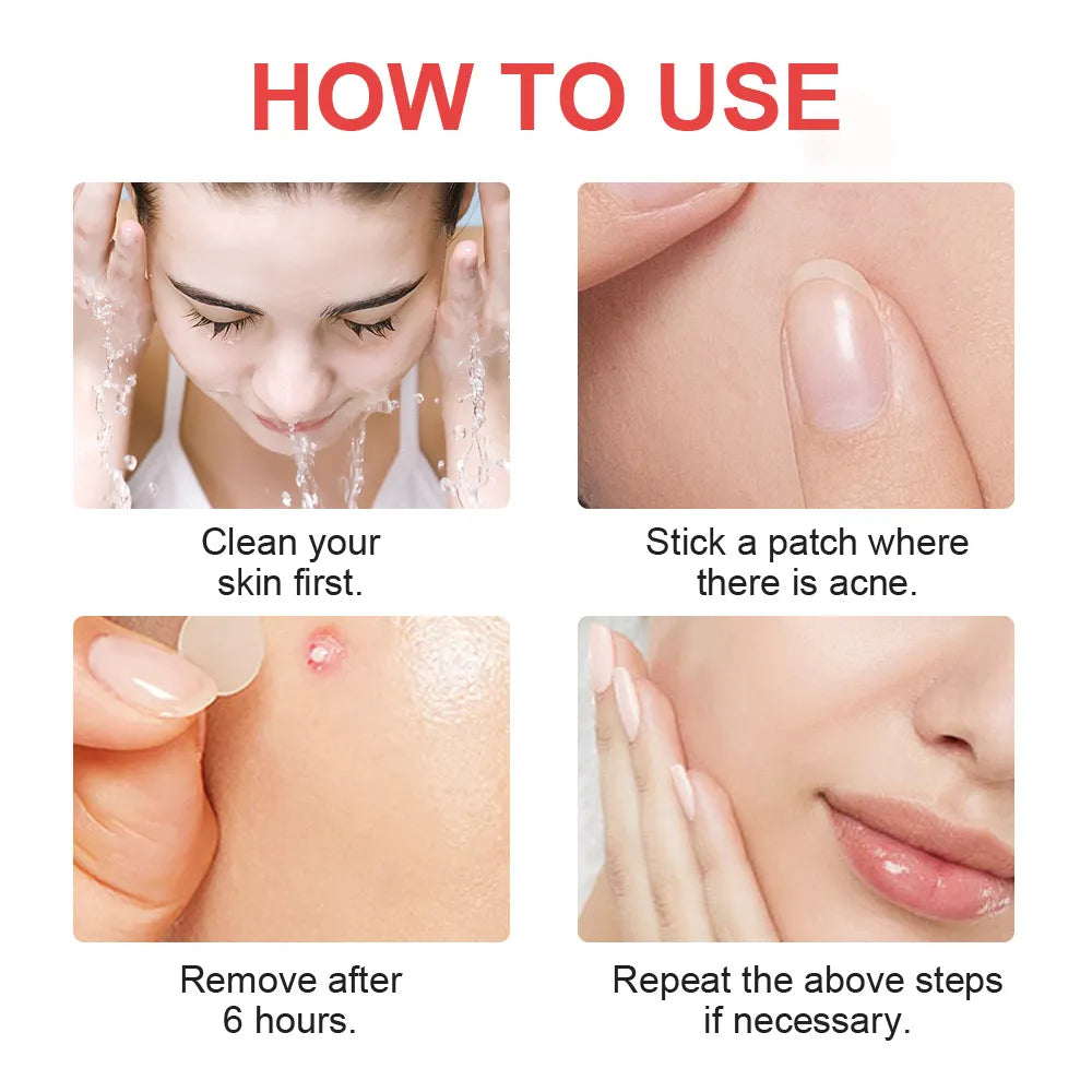 Hydrocolloid Invisible Acne Patch for Fast Blemish Healing