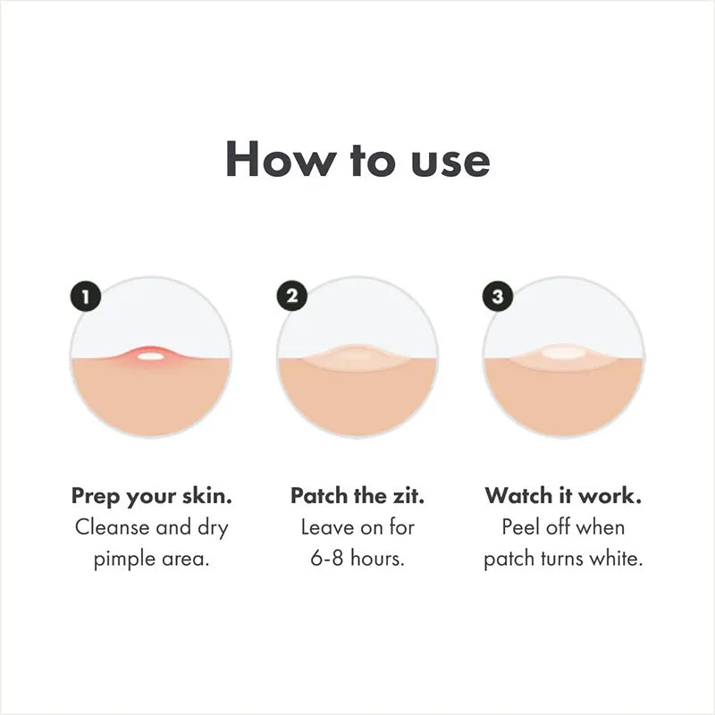 Chin Acne Day & Night Repair Patch for Fast Healing