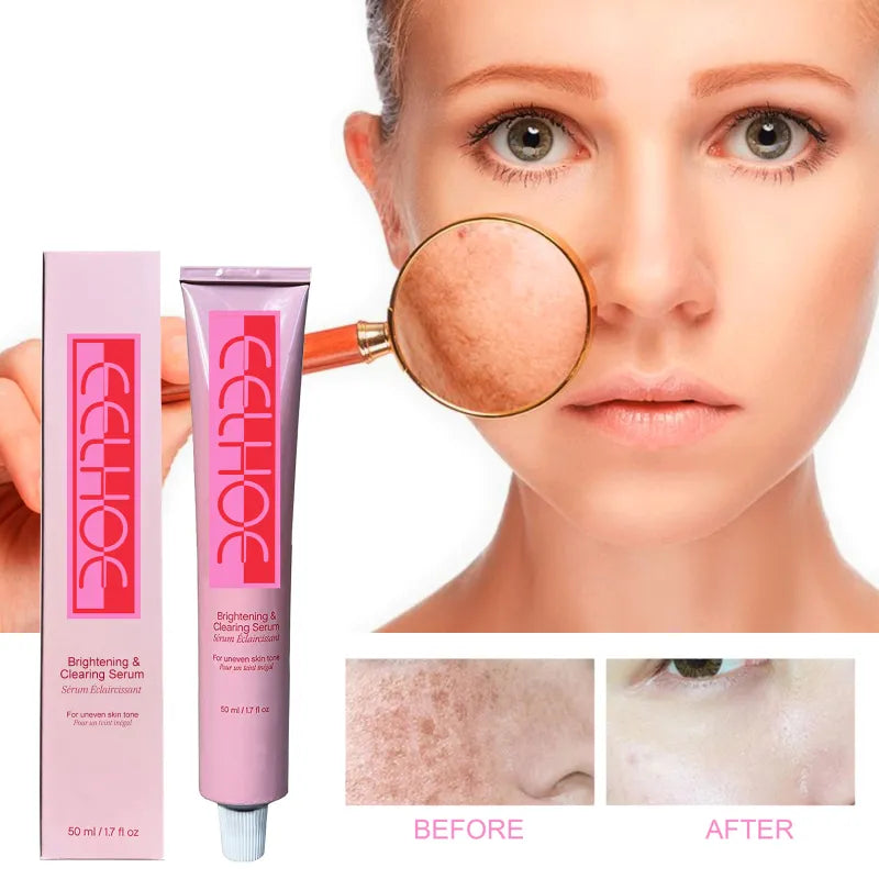 Fade Skin Spots with Hydrating Comfort Lotion