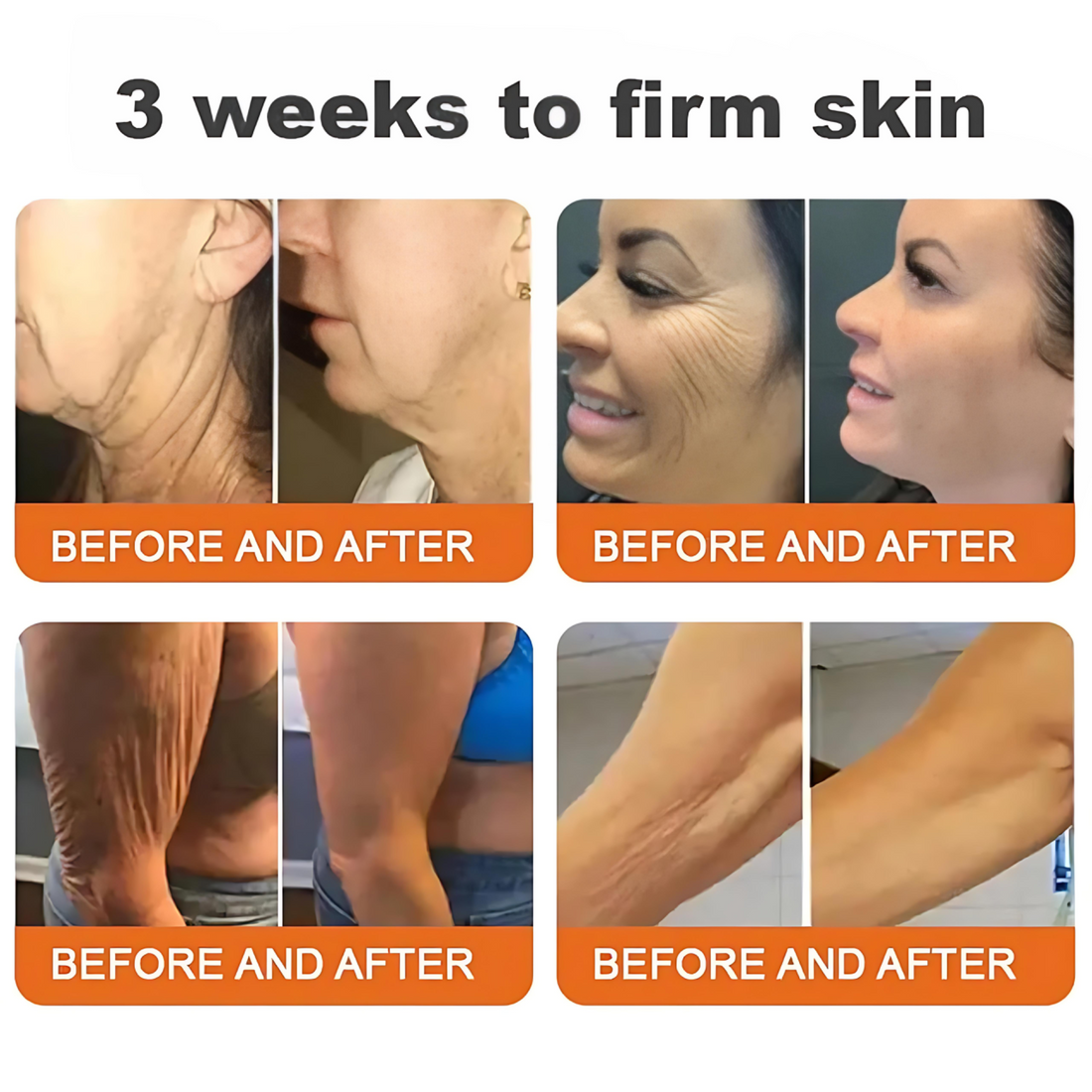 &quot;Bee Venom Anti-Aging Facial Cream – Hydrates, Firms &amp; Brightens&quot;