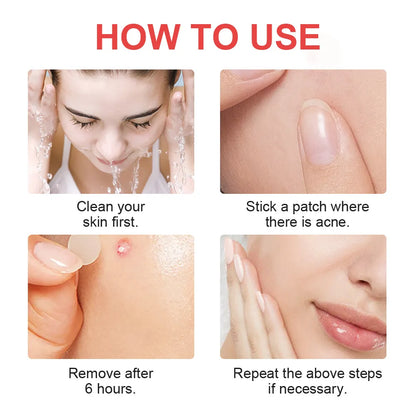 Hydrocolloid Invisible Acne Patch for Fast Blemish Healing