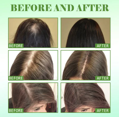 Nourishing Rosemary Hair Repair Essential Oil for Growth