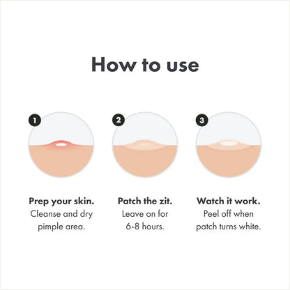 Chin Acne Day &amp; Night Repair Patch for Fast Healing