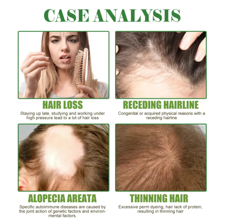 Nourishing Rosemary Hair Repair Essential Oil for Growth